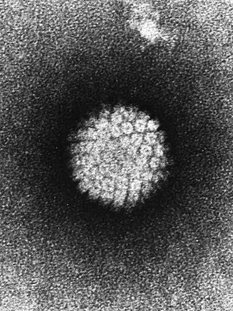 Papillomavirus