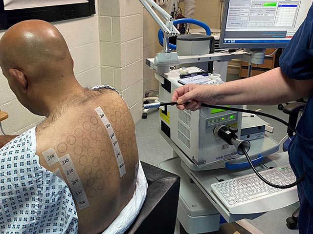 Undertaking monochromator light testing - differing doses of different wavelenghts of UVB, UVA, and visible light are delivered