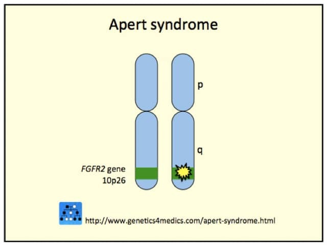 Crouzon syndrome genetics*