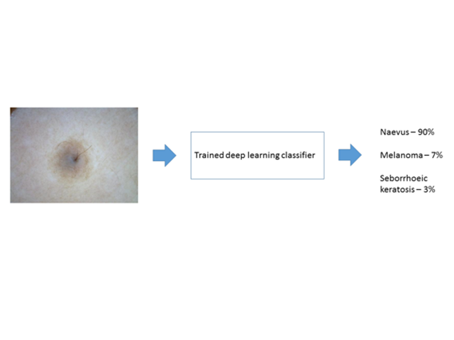 Inference produced by deep learning algorithms on a new image of a skin lesion.