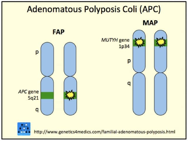 Genetics of Gardner syndrome*