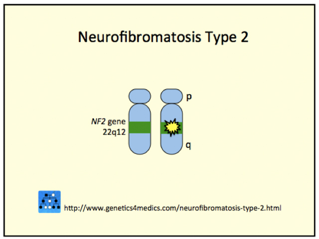 Neurofibromatosis Type 2