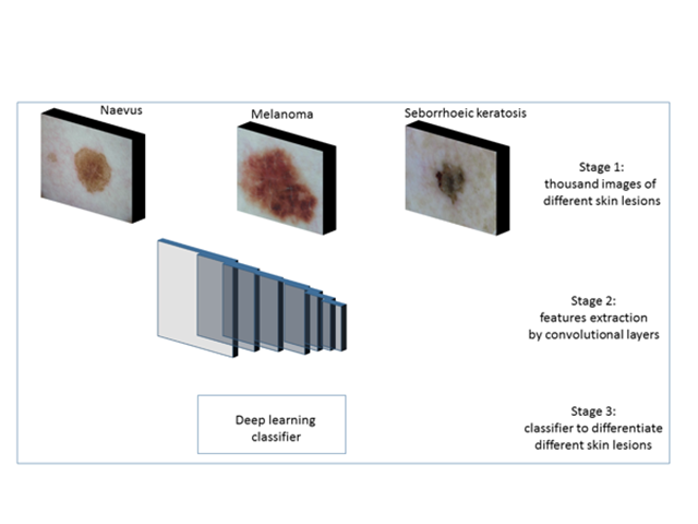 Overview of training of different types of skin lesions with the help of deep learning.