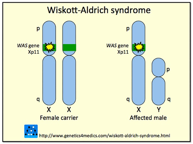 Genetics of Wiskott-Aldrich syndrome*