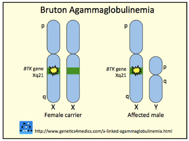 Genetics of X-Linked-agammaglobulinemia