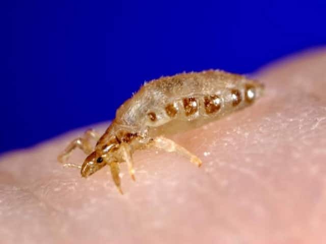 Body louse