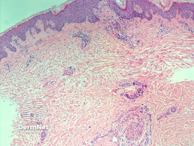 H&E stain