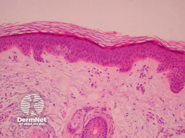 Haematoxylin and eosin-stained