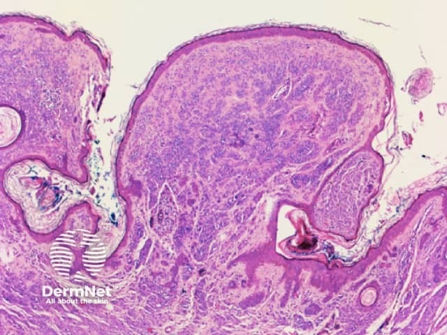 Figure 46b