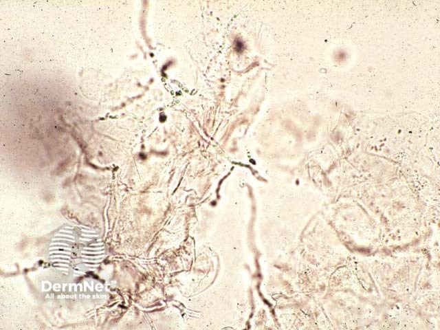 Microscopy of Microsporum canis