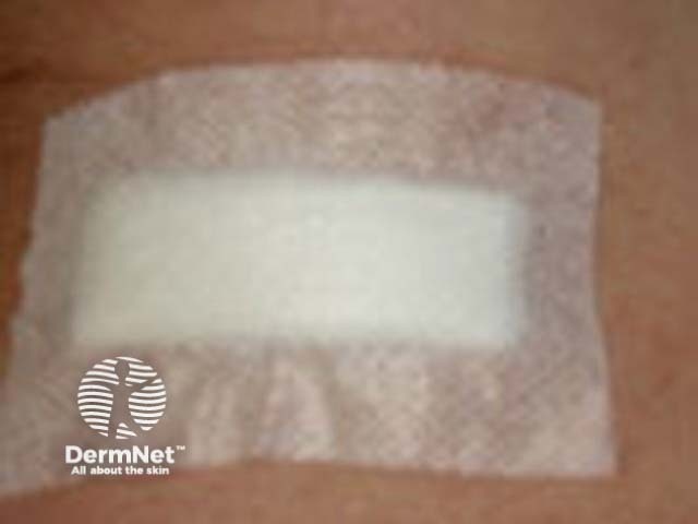 Wound dressing