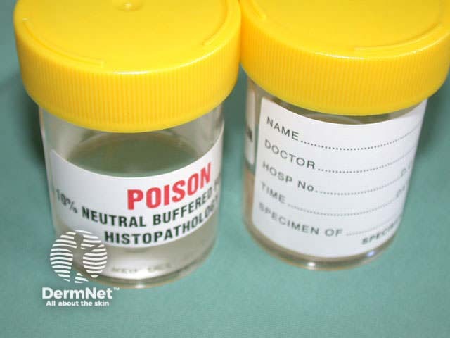 Formalin pot