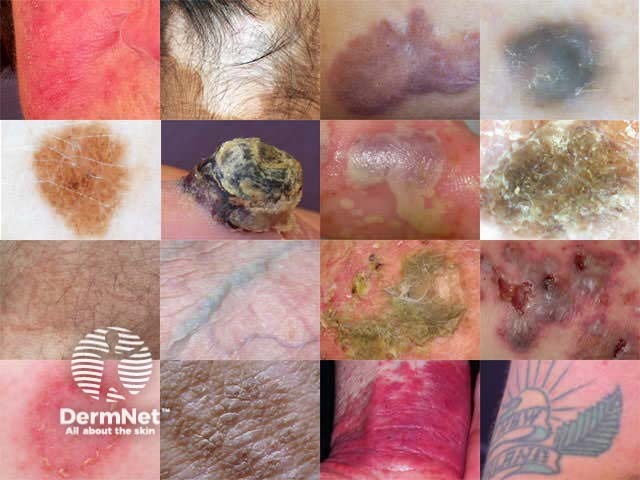 Cutaneous colours