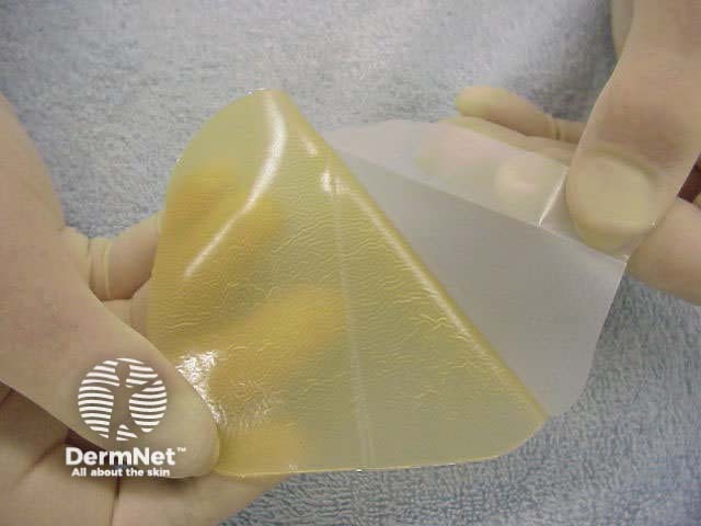 Duoderm™ hydrocolloid dressing