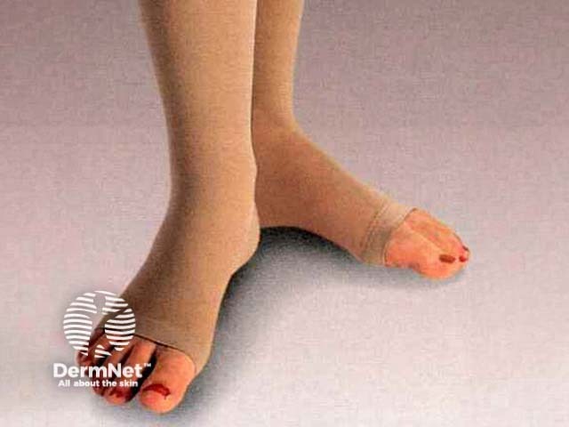 Sigvaris compression stockings