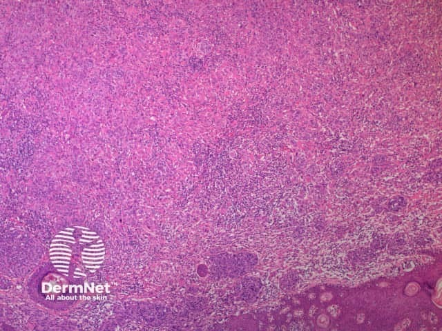 b. x 4, haematoxylin and eosin stain