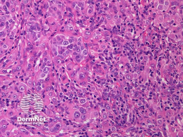 c. x 20, haemotoxylin and eosin stain