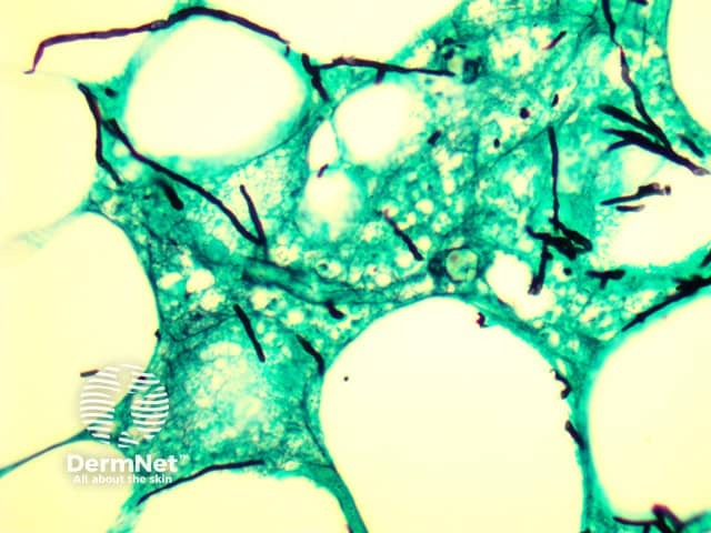 Histopathology