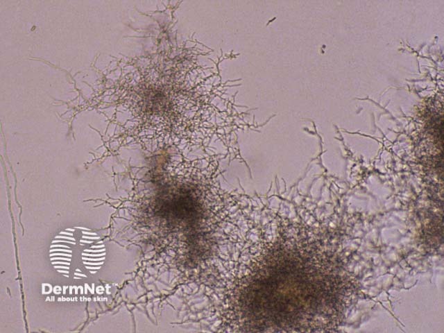 Nocardia in agar