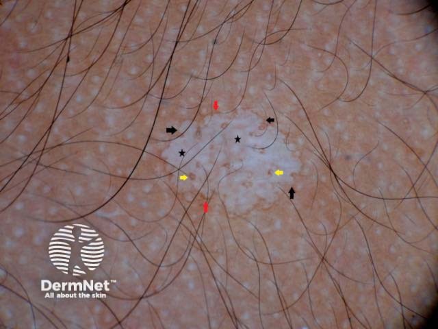 Fig. 1. Amoeboid pattern