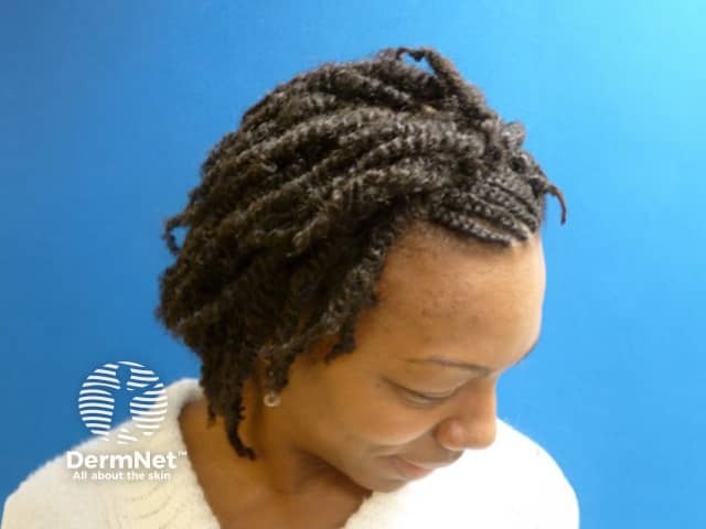 Natural hair twisted in woman of African descent