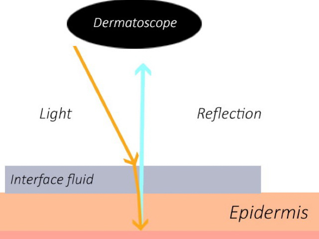 Nonpolarised dermoscopy