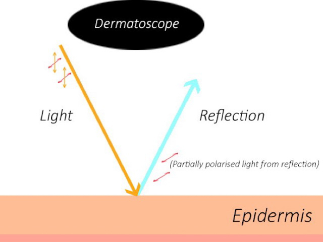 Normal light reflection off skin