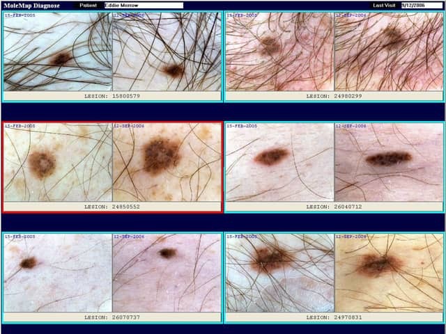 Repeat imaging. Red border indicates lesion has changed