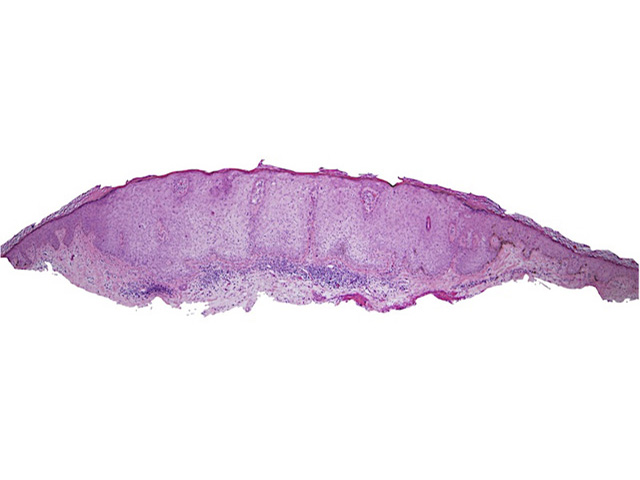 Histopathology