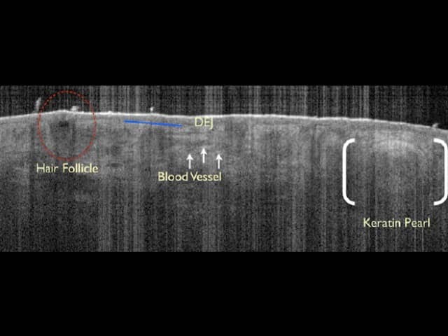 Epidermal and dermal structures