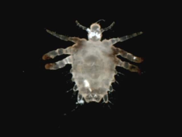 Pubic louse