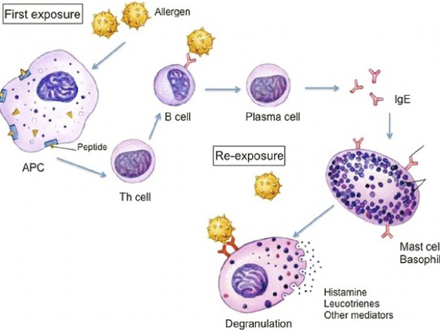 Type 1 hypersensitivity reaction