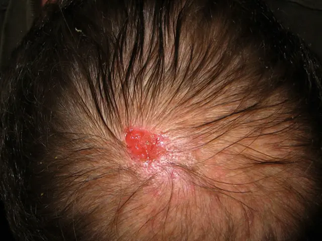 Scalp images